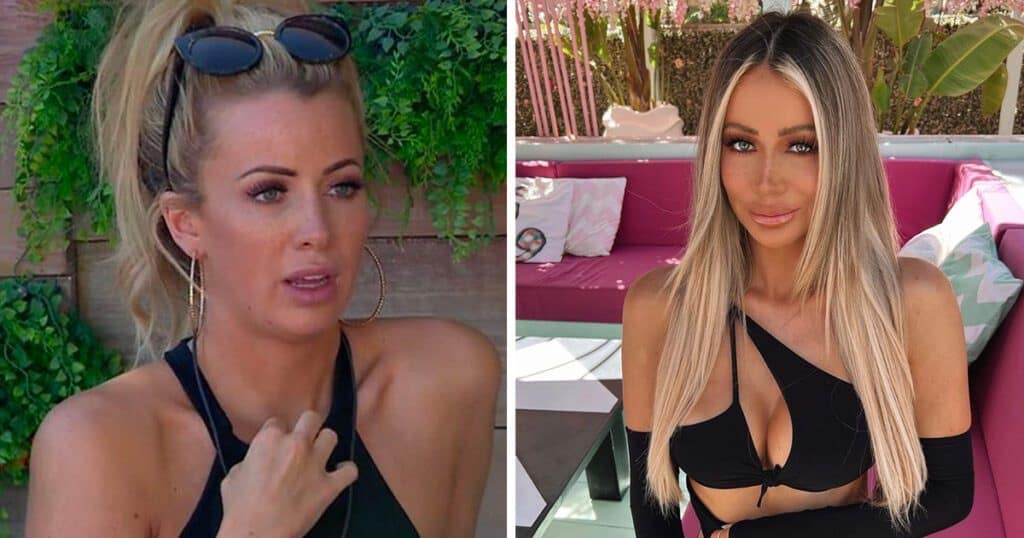 Olivia Attwood Before And After