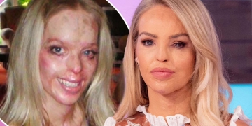 Katie Piper