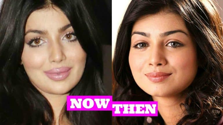 Ayesha Takia Before and After