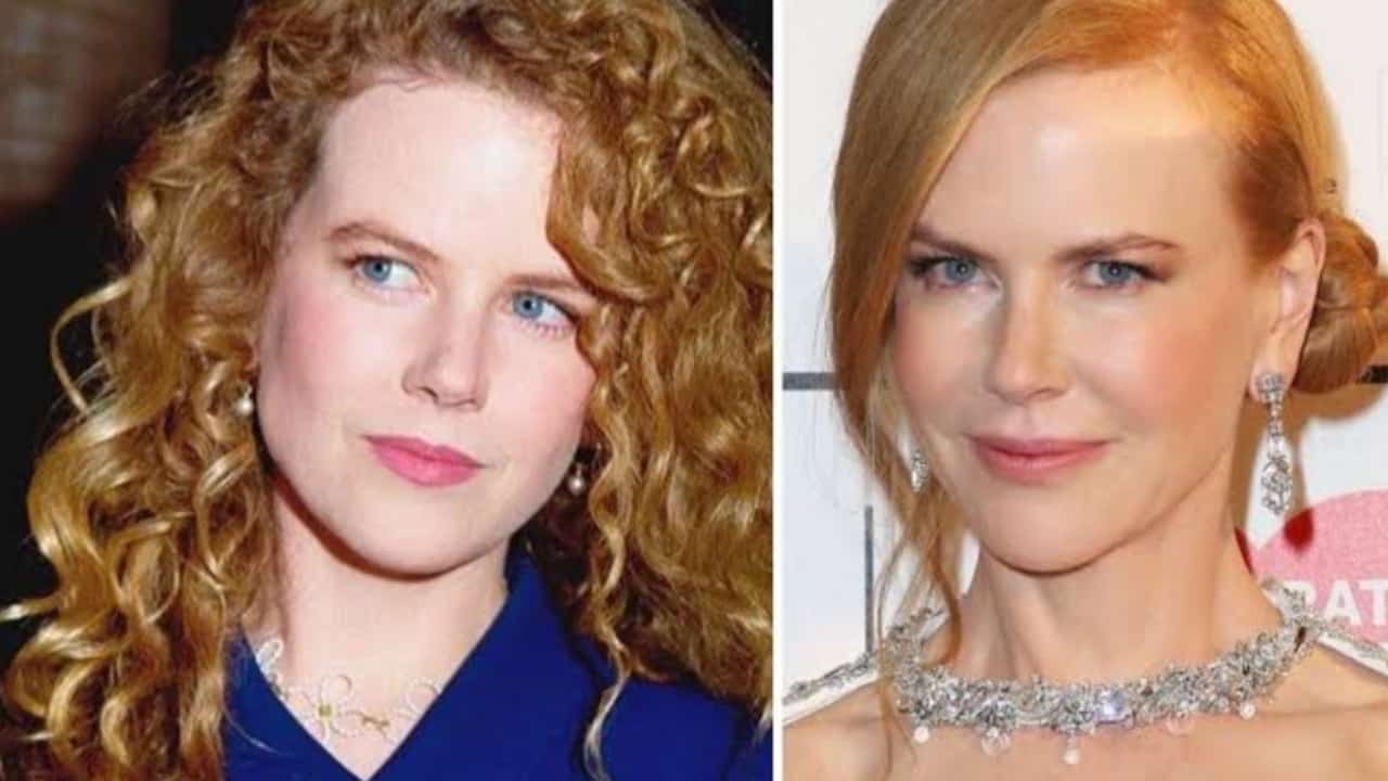 Nicole Kidman's Before And After Looks