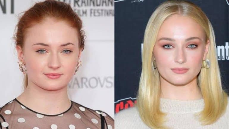 Featured - Sophie Turner Plastic Surgery