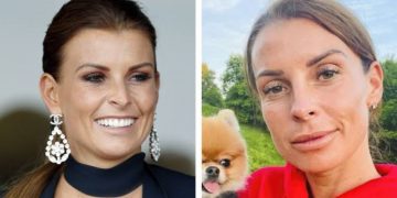 Coleen Rooney's Before And After Looks