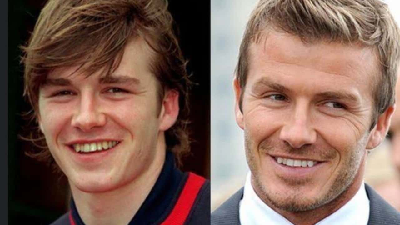 David Beckham's Before And After Looks