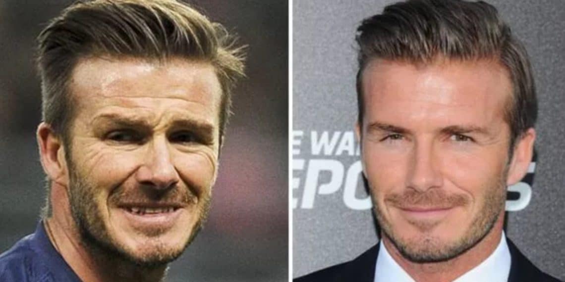 David Beckham's Before And After Looks