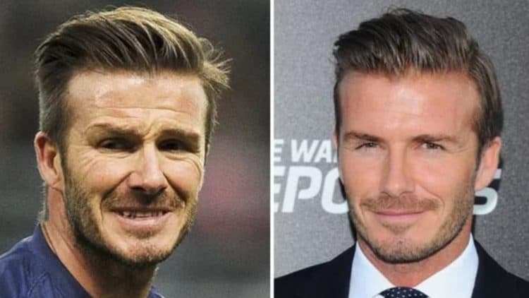 David Beckham's Before And After Looks