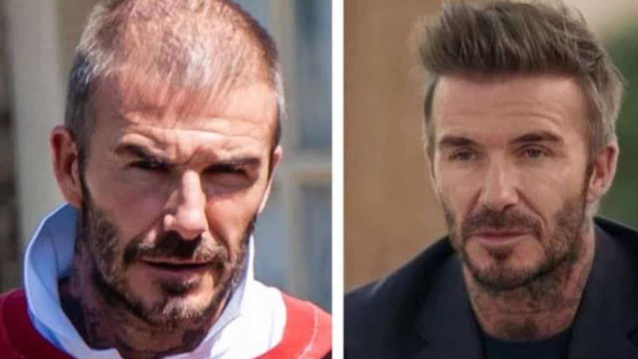 David Beckham's Before And After Looks