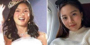 Kim Chiu's Before And After Looks