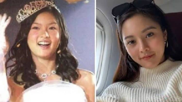 Kim Chiu's Before And After Looks