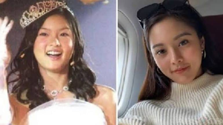 Kim Chiu's Before And After Looks