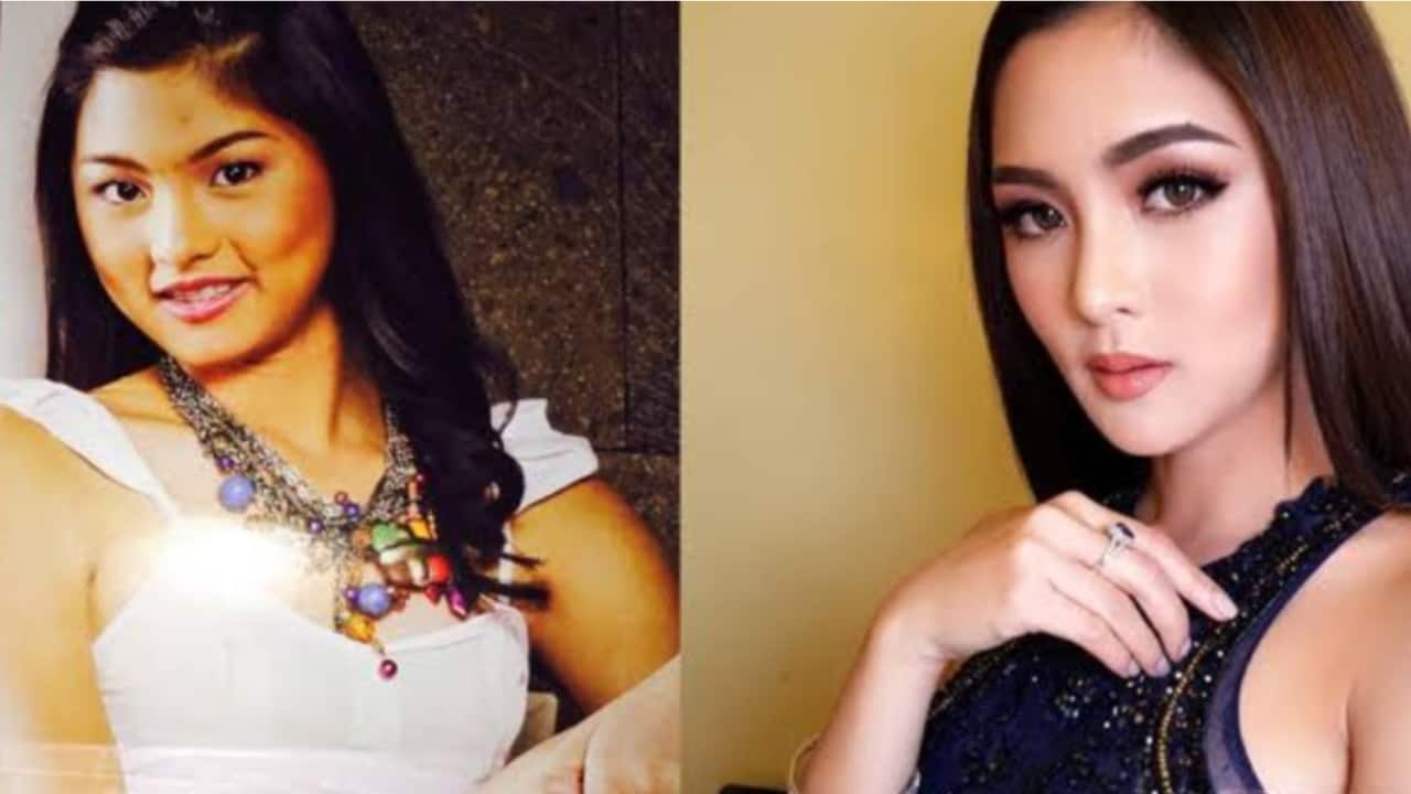 Kim Chiu's Before And After Looks