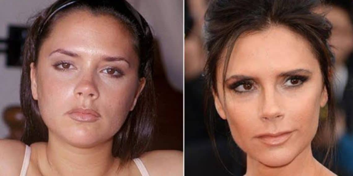 Victoria Beckham's Before And After Looks