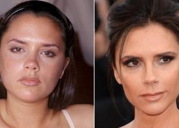 Victoria Beckham's Before And After Looks