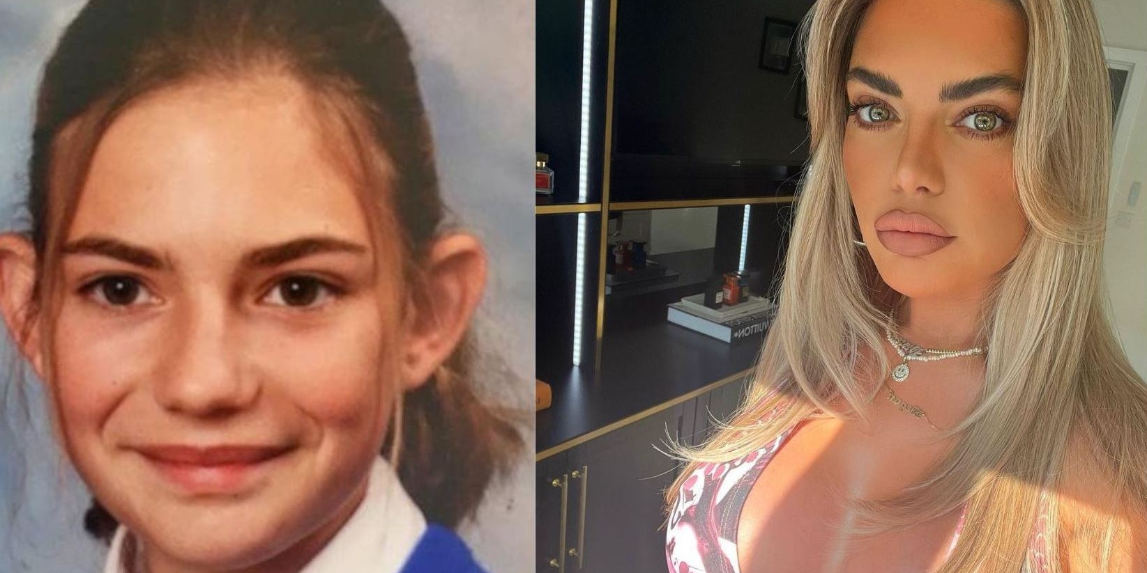 Megan Barton Hanson Before (L) and After (R) (Credits: Instagram/@meganbartonhanson)