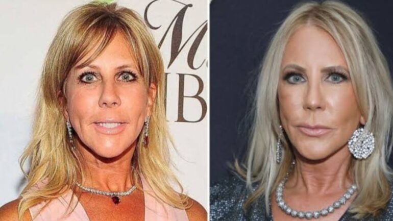 Vicki Gunvalson's Before And After Looks: The RHOC Alum's ...