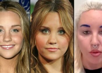 Amanda Bynes' Before And After Looks
