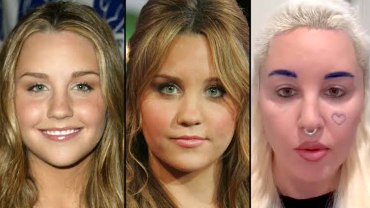 Amanda Bynes' Before And After Looks