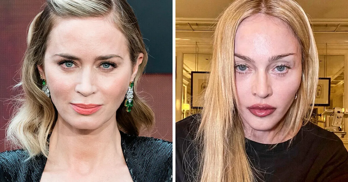 Emily Blunt Before and After - Did She Go for a Plastic Surgery?