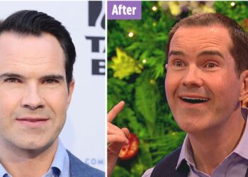 Jimmy Carr Before and After