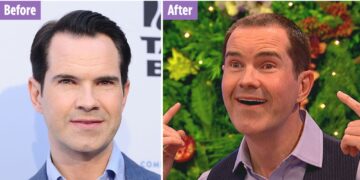 Jimmy Carr Before and After