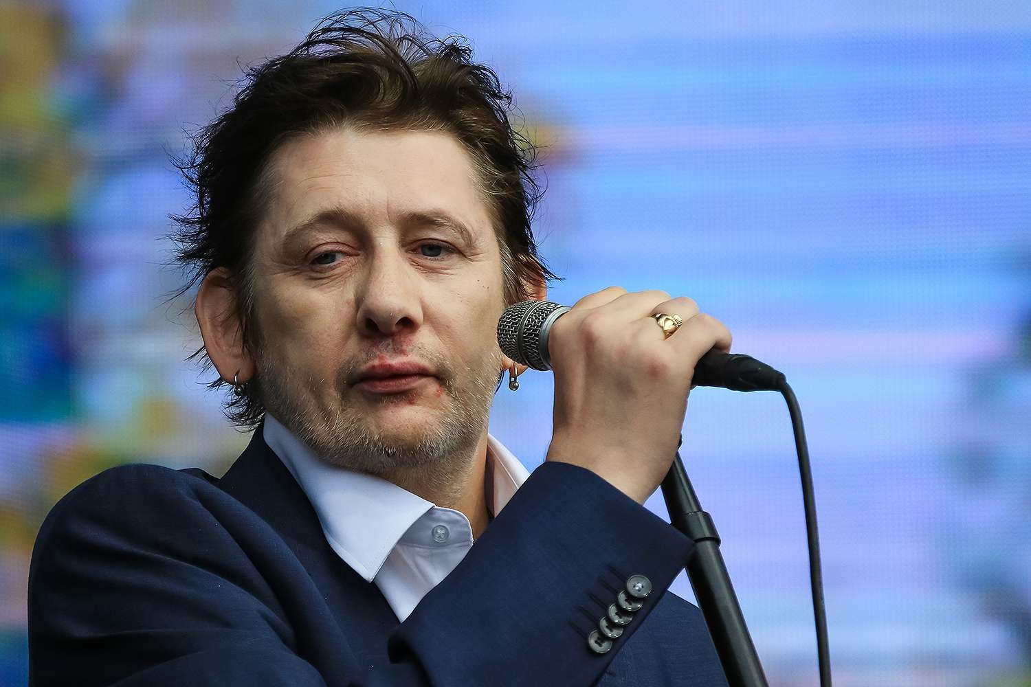 Shane Macgowan Teeth Before and After the Fracture