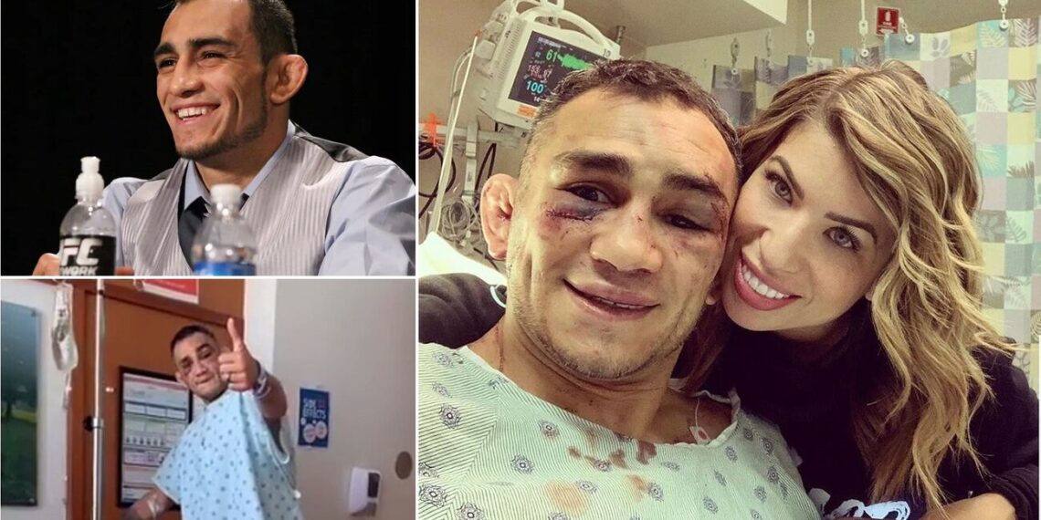 Tony Ferguson Before And After