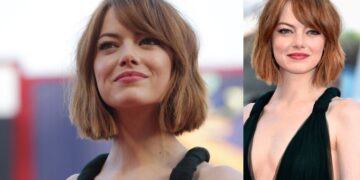 Emma Stone Before And After