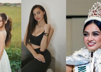 Kylie Verzosa Before and After
