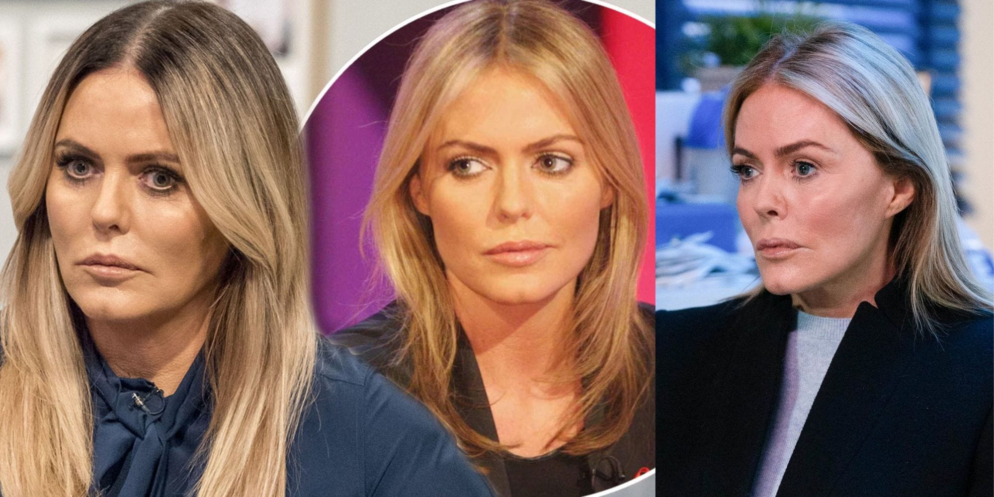 Patsy Kensit Before and After