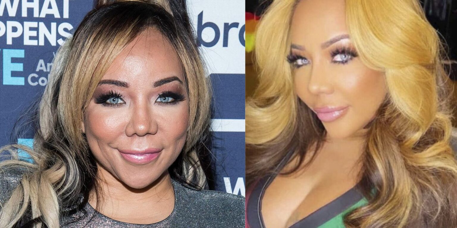 Tiny Harris Before and After Plastic Surgery — OtakuKart(01)