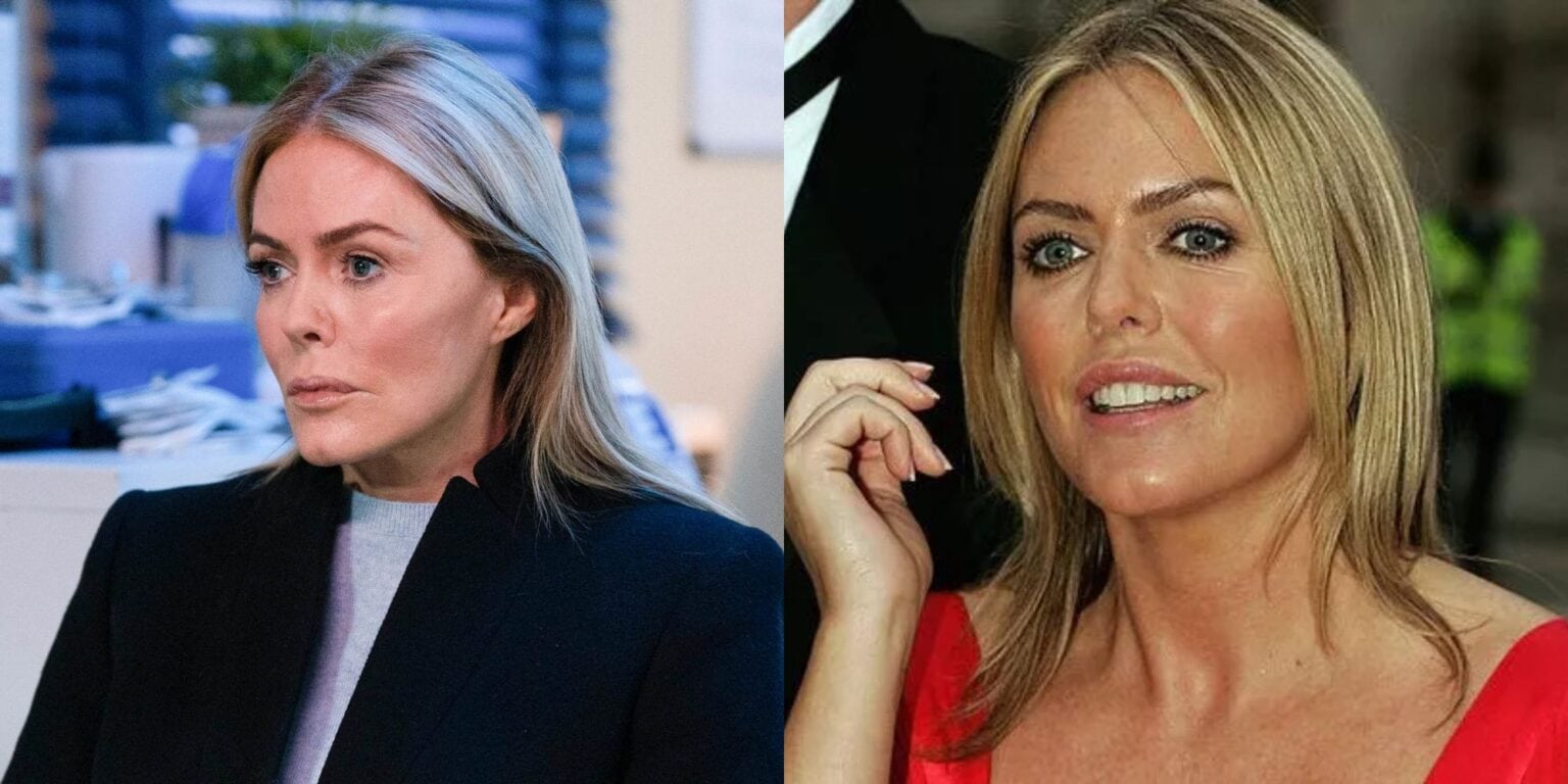 Patsy Kensit Before and After: Did She Do Any Plastic Surgery? — OtakuKart