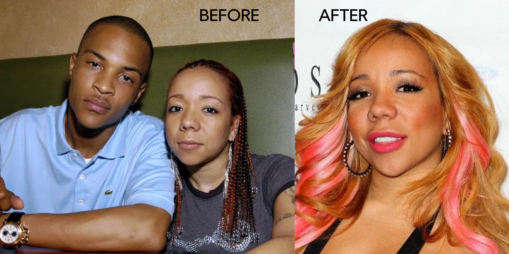 Tiny Harris Before and After