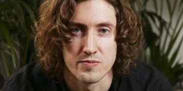 Dean Lewis Reveals “The Epilogue” Album and Nationwide Tour