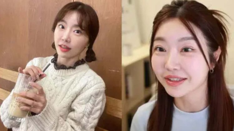 Lady Jane and her double eyelid surgery