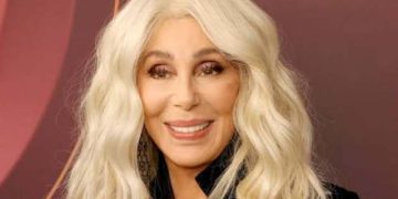 What Happened To Cher? Change In Her “Lower Lip” Appearance