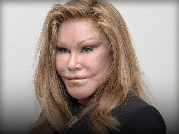 Jocelyn Wildenstein