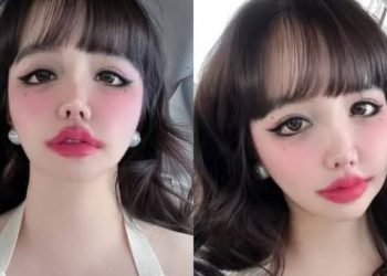 7teg(7) - D-NATION Entertainment Issues Detailed Update on Park Bom’s Emotional Health and Urges Respect for Her Privacy